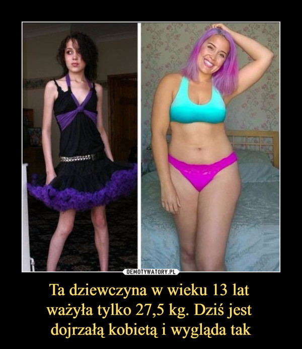 Ta dziewczyna w wieku 13 lat ważyła tylko 27,5 kg. Dziś jest dojrzałą kobietą i wygląda tak –  