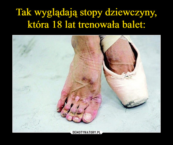 Tak wyglądają stopy dziewczyny, która 18 lat trenowała balet: