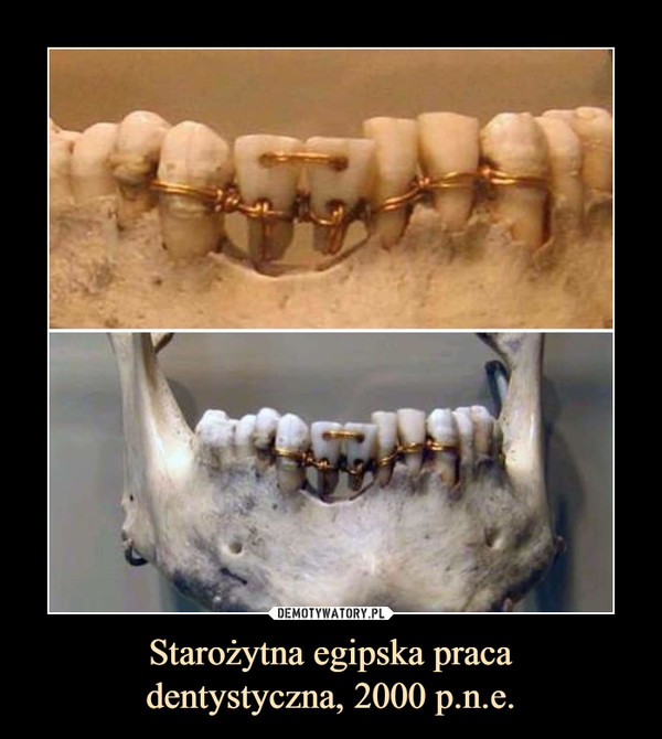 Starożytna egipska praca
dentystyczna, 2000 p.n.e.