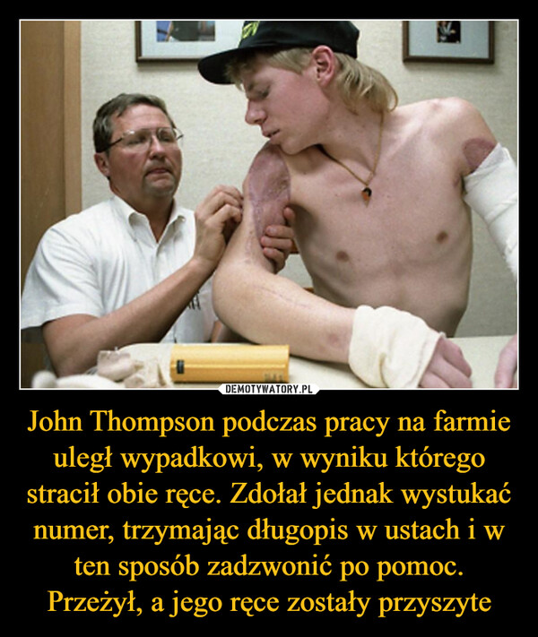 John Thompson podczas pracy na farmie uległ wypadkowi, w wyniku którego stracił obie ręce. Zdołał jednak wystukać numer, trzymając długopis w ustach i w ten sposób zadzwonić po pomoc. Przeżył, a jego ręce zostały przyszyte –  